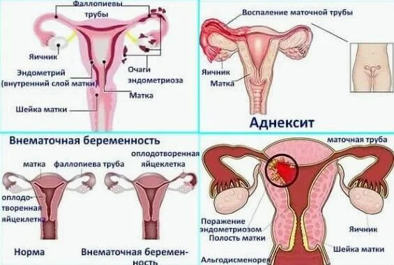 Болит низ живота во время полового. Овуляция боль внизу живота. Боли при овуляции внизу живота. При овуляции болит низ живота. При овуляции может болеть низ живота.