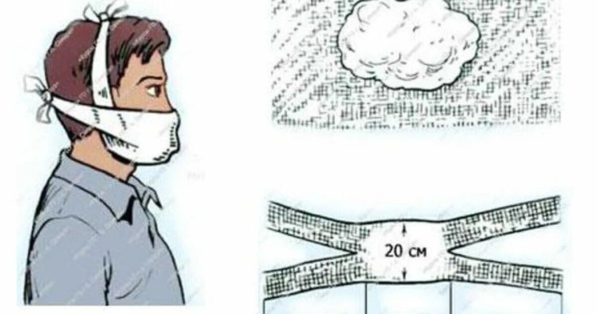 Ватно марлевая повязка обж 8 класс. Способ изготовления ватно марлевой повязки. Ватно марлевая маска схема. Изготовление ватно марлевой повязки инструкция. Изготовление ватно марлевой повязки инструкция.
