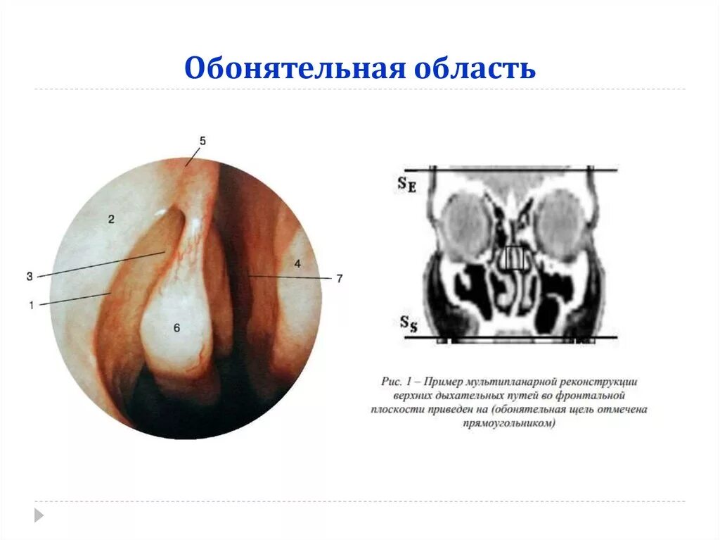 Обонятельные отверстия. Вкусовой и обонятельный анализаторы анатомия. Обонятельные отверстия. Вомероназальный орган анализатор человека. Клетки обонятельной слизистой оболочки.