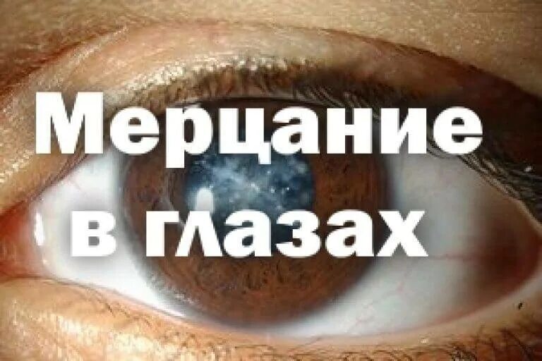 Сверкает в глазу сбоку причины. Сверкает в глазу сбоку причины. Сверкает в глазу сбоку причины. Блеск в глазах. Мерцательная скотома аура мигрени.