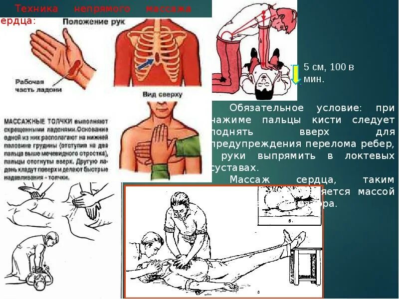 Остановка дыхания алгоритм. Первая помощь при остановке дыхания и кровообращения. Оказание первой помощи при отсутствии кровообращения. Оказание первой помощи при остановке кровообращения. Оказание помощи при остановки дыхания и кровообращения.