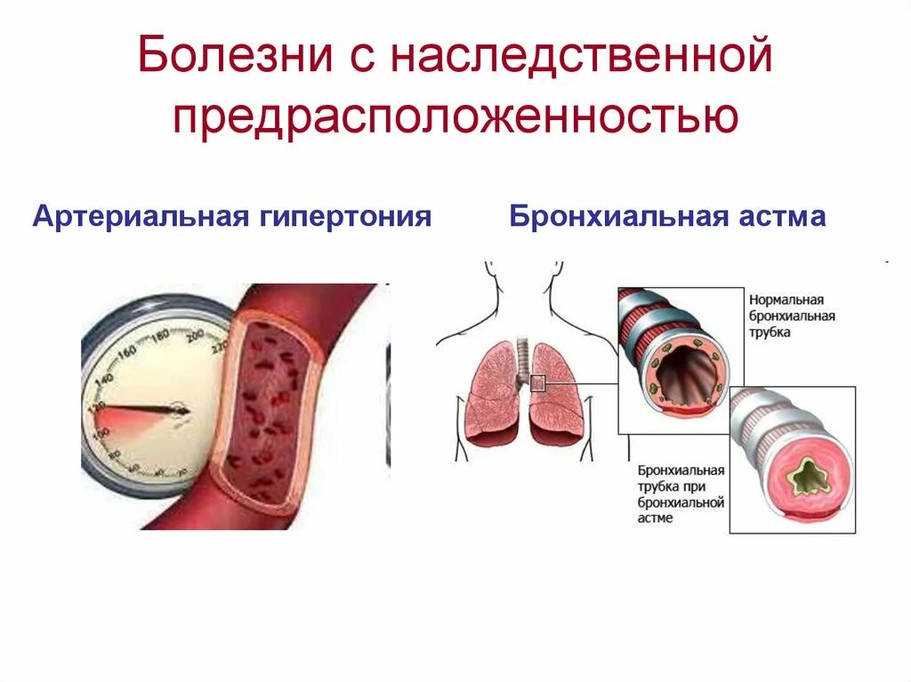 Заболевания с наследственной предрасположенностью мультифакторные. Заболевания с наследственной предрасположенностью наследуются. Болезни с наследственной предрасположенностью примеры. Болезни с наследственным предрасположением (мультифакториальные). Заболевания с наследственной предрасположенностью