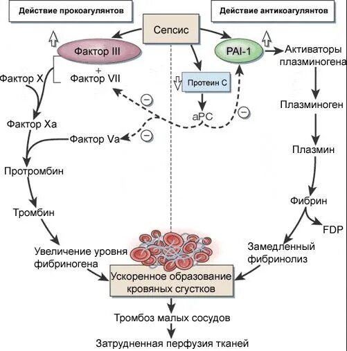 Схема свертывания крови антикоагулянты. Механизм действия антикоагулянтов схема. Схема механизм действия противосвертывающей системы крови. Схема свертывания крови фармакология. Гепарин при тромбозе