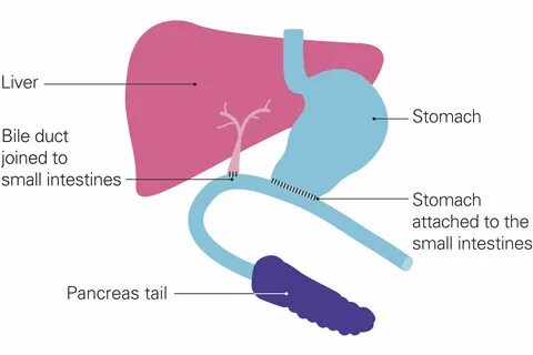 The liver and bile duct are on the left, coloured in shades of pink. 