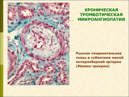 Начальные проявления микроангиопатии