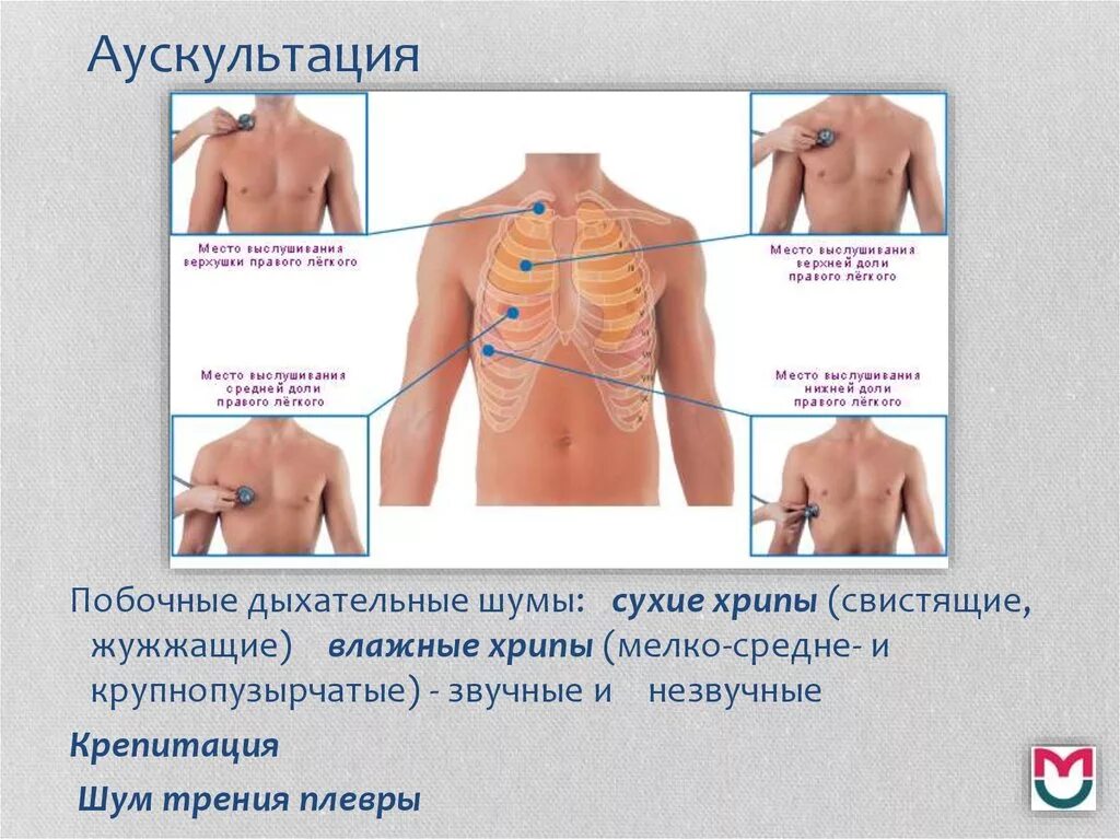 Точки аускультации легких спереди. Аускультация органов дыхания. Точки аускультации легких у детей спереди. Бронхит курильщика аускультация.