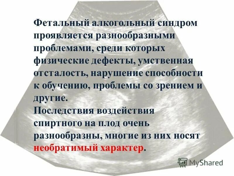 Признаки фетального алкогольного. Фетальный алкогольный синдром. Фетальный алкогольный синдром плода. Алкогольный синдром плода (фетальный алкогольный синдром)..