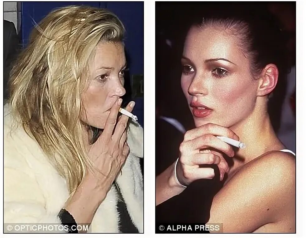 Курящие до и после. Кейт Мосс курит. Кейт Мосс наркотики. Кейт Мосс кожа.