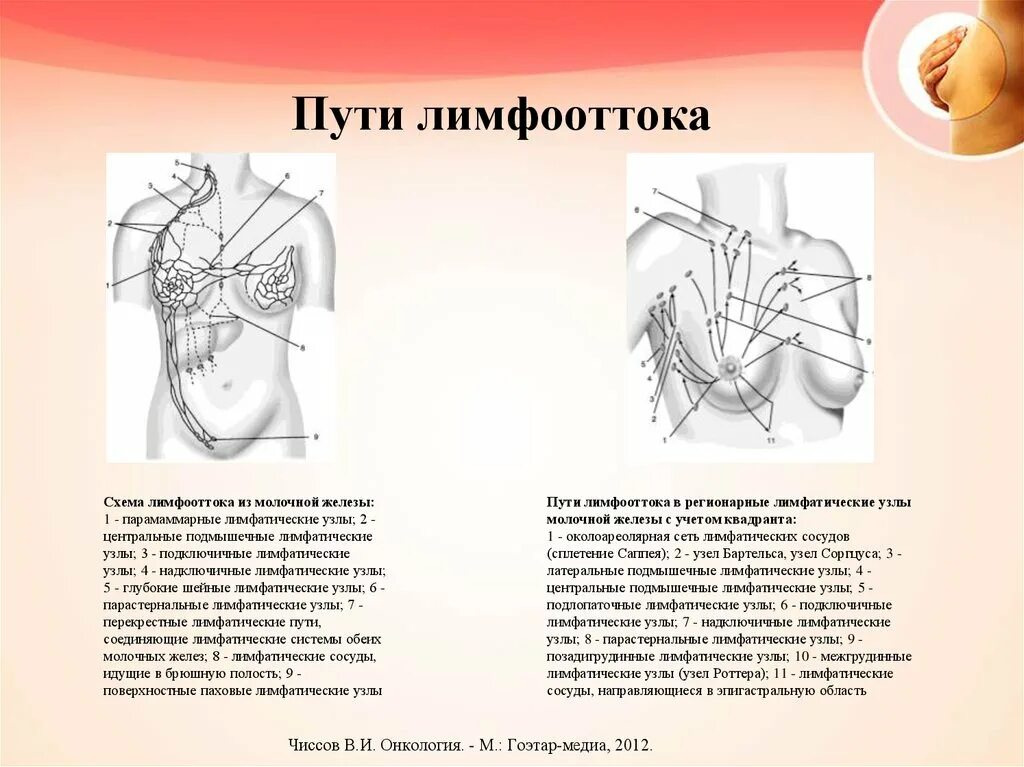 Удаление груди и лимфоузлов. Регионарные лимфоузлы молочной железы. Лимфатические узлы подмышечной впадины топографическая анатомия. Молочная железа отток лимфы схема. Уровни аксиллярных лимфоузлов схема.