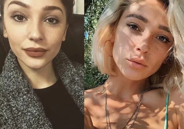 Настя ивлеева раньше. Настя ивлеева раньш ше. Ивлева до и после. Ивлеева до и после пластики. Настя ивлиева до после пластики.