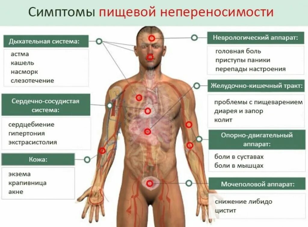 Температура боли в суставах сыпь. Пищевая аллергия симптомы. Непереносимость глютена симптомы. Пищевая аллергия признаки.