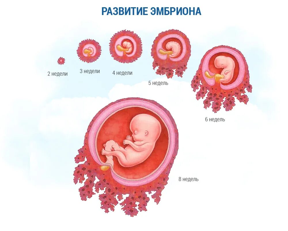 Эмбрион на 4 неделе беременности аборт. 5 Недель беременности аборт. Выкидыш на 6 неделе беременности. Эмбрион на 5 неделе при медикаментозном аборте. 1 неделя беременности что делать