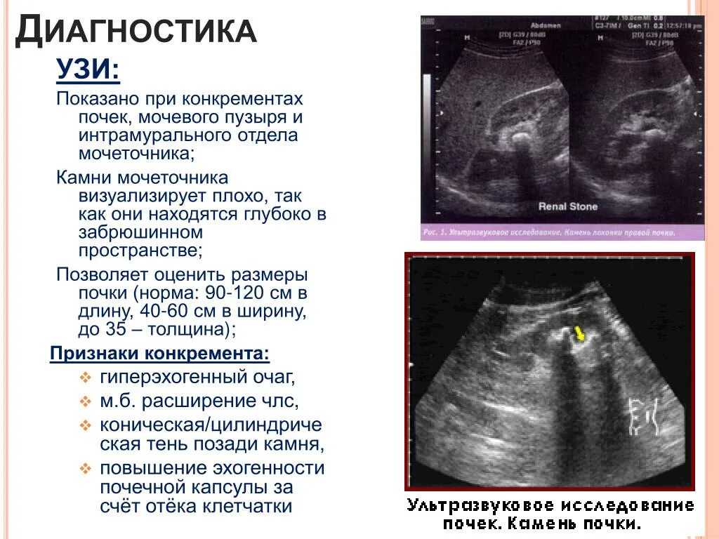 Гиперэхогенным округлым образованием. Гиперэхогенные включения. Гиперэхогенные структуры на УЗИ. Гиперэхогенное образование.