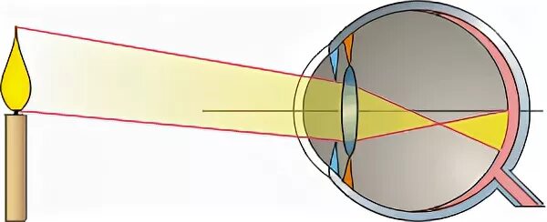 Преломление световых лучей в глазу. Преломление лучей на сетчатку. Преломление лучшей в глазе. Преломление света в сетчатке глаза.