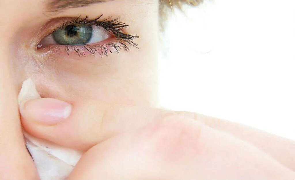 Лечение слезотечения глаз у взрослых. Аллергия слезятся глаза. Аллергическая реакция на глазах. Аллергическое слезотечение.