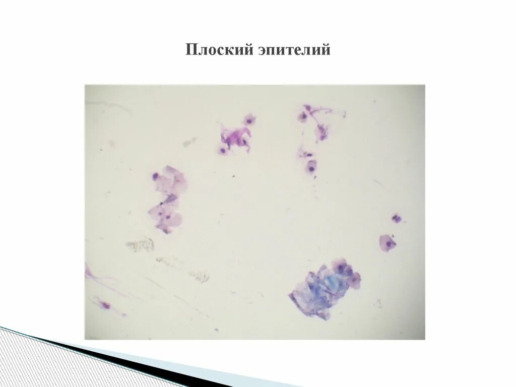 Цилиндрический мерцательный эпителий в мокроте. Клетки бронхиального эпителия. Плоский и цилиндрический эпителий в мазке. Плоский и цилиндрический эпителий в мазке. Атлас микроскопия гинекологических мазков.
