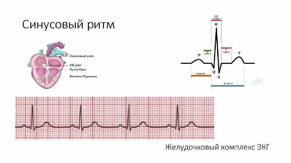 Правильный синусовый ритм на экг. Синусовый ритм на экг. Критериинесинусового ритма на экг. Синусовый и несинусовый ритм экг. Экг нормальные синусовый ритм норма.