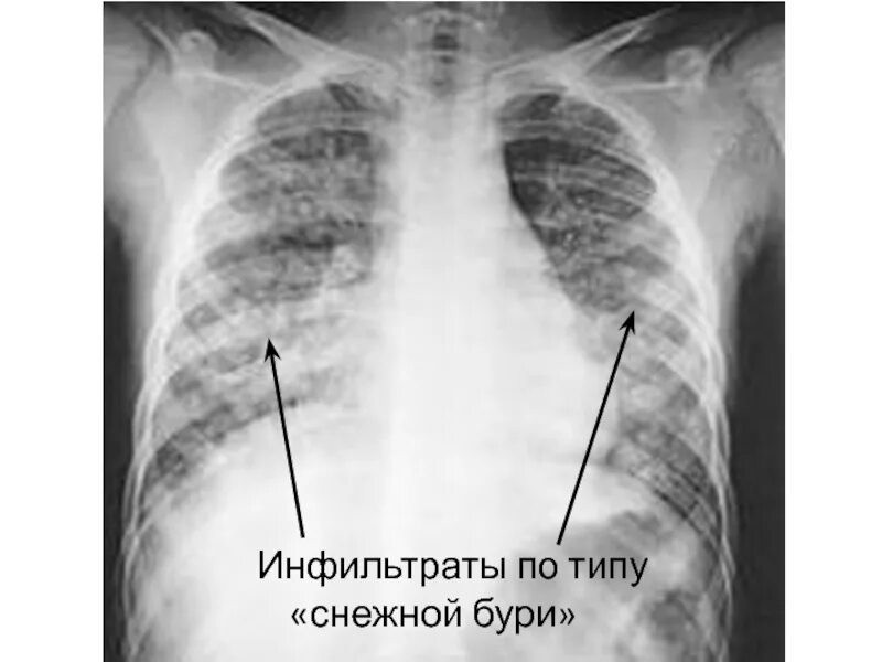 Снежная буря легкие. Метель фон. Снежная буря легкие. Вьюга. Снежная буря легкие.