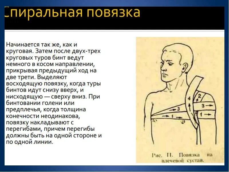 Сколько нужно делать перевязки. Виды перевязок. Перевязки виды перевязок. Перевязки виды перевязок в картинках.