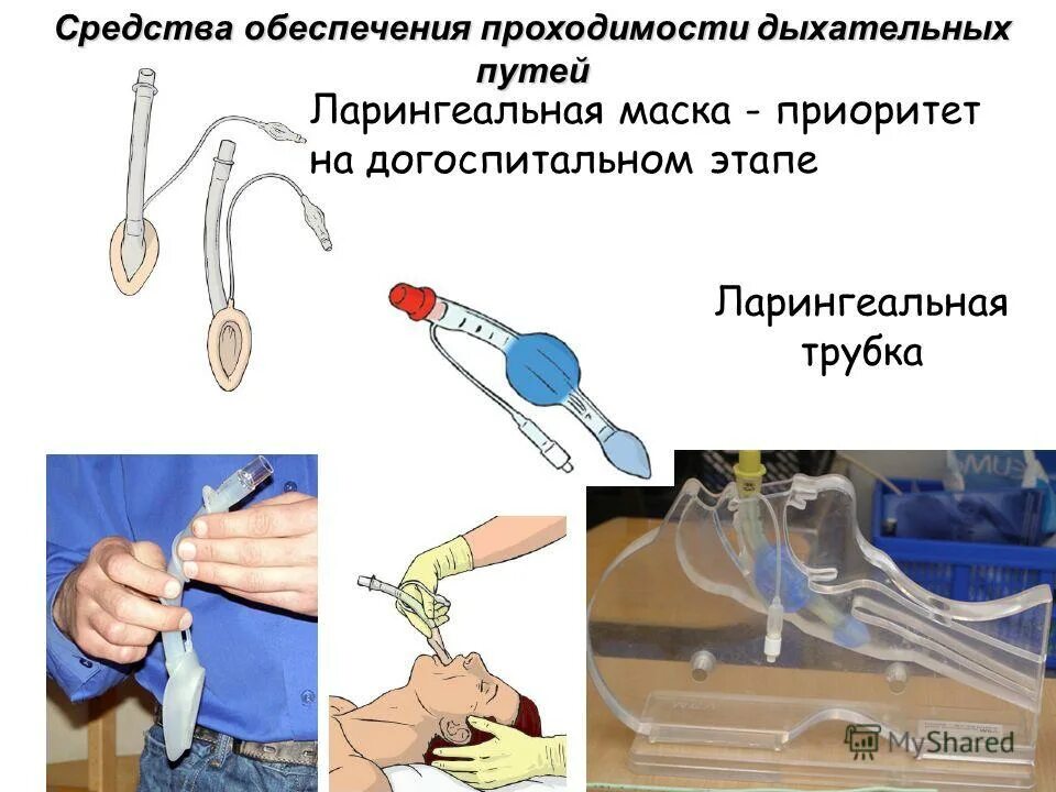 методы обеспечения дыхательных путей