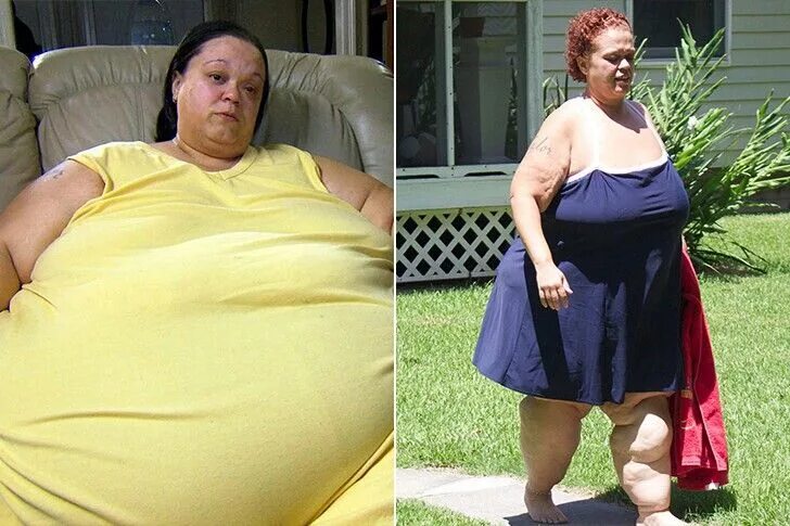 Стс про толстых людей. Эшли Данн-Братчер толстая. Эшли Тейлор я вешу 300 кг.