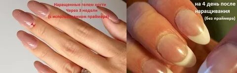 3 месяца ногтям