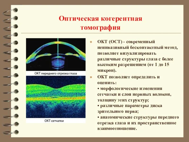 Ост результат. Оптическая когерентная томография сетчатки. Оптическая когерентная томография (окт, Oct). Когерентная томография сетчатки глаза норма. Оптическая когерентная томография что это такое в офтальмологии.