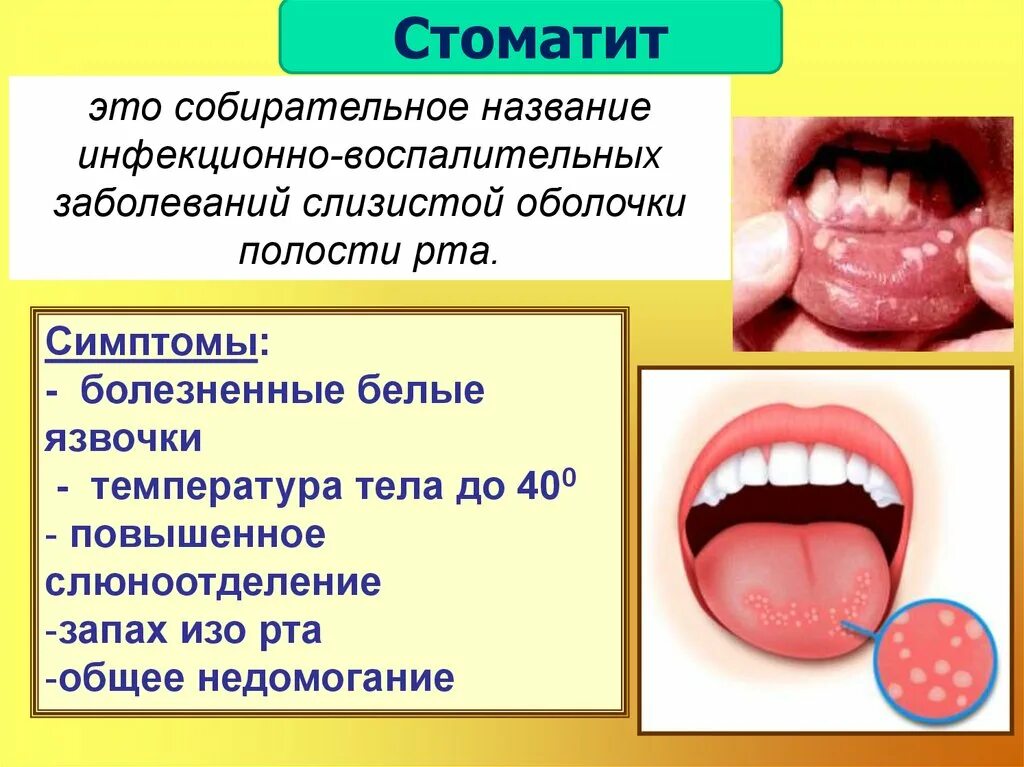 Кашель язык