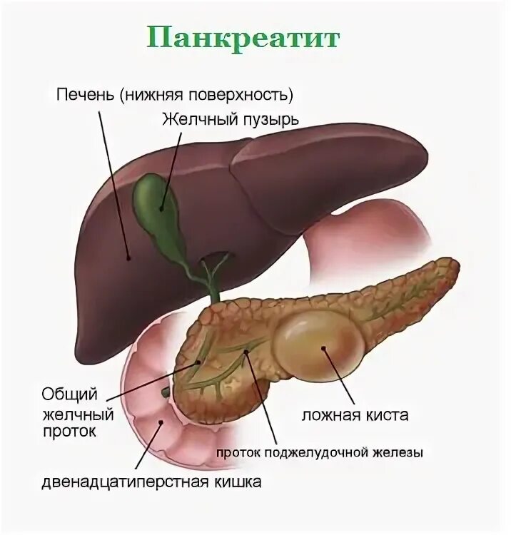 Боли в печени и поджелудочной. Панкреатит поджелудочной железы. Спазмы поджелудочной железы.