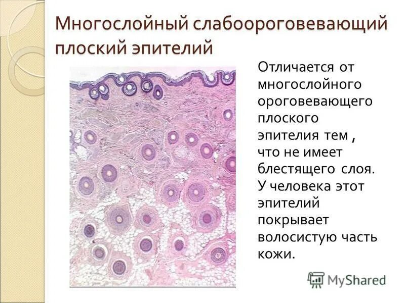 Многослойный плоский неороговевающий эпителий функции. Многослойный плоский неороговевающий эпителий полости рта. Ороговевающий эпителий функции. Многослойный плоский неороговевающий эпителий роговицы глаза. Ороговевающий эпителий функции.
