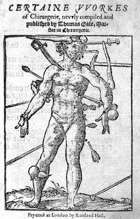 Wound man
