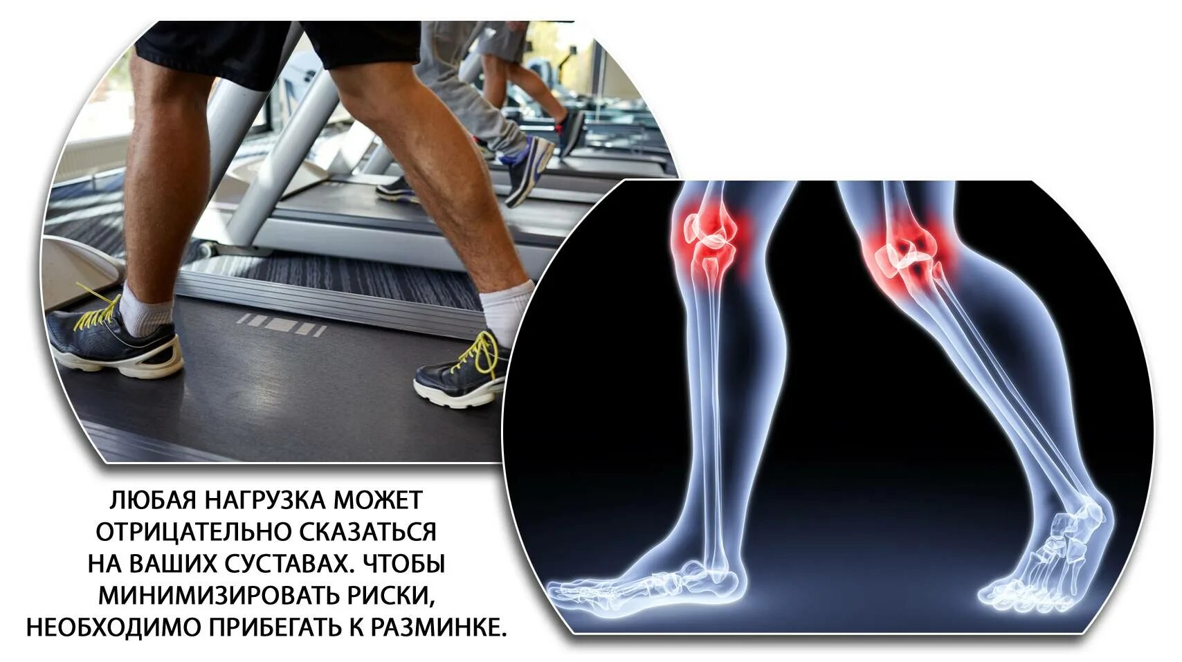 боли в суставах после физической нагрузки