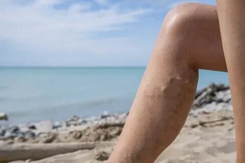 Емізіктердің фотосуреттерін қарастырайық