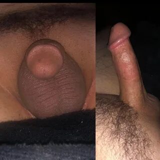 Effects of Early Masturbation on the Penis.