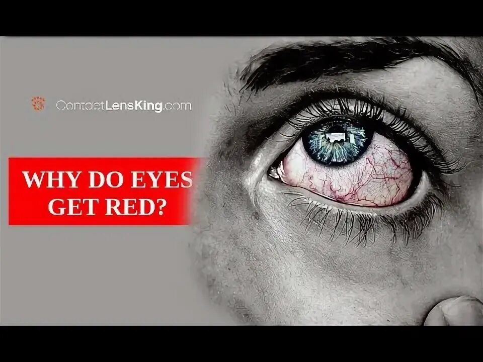Eyes do it what is it. Eyes do it what is it