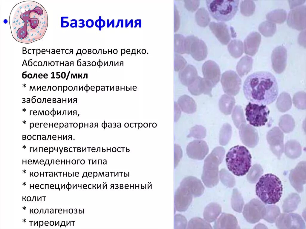 Базофилия заболевания. Абсолютная базофилия. Базофильный лейкоцитоз. Базофильная цитоплазма это. Абсолютный лейкоцитоз