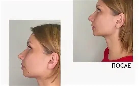 Ортошик стоматология спб. Орто шик стоматология спб блюхера. Орто шик. Орто шик. Клиника маршал в сестрорецке.