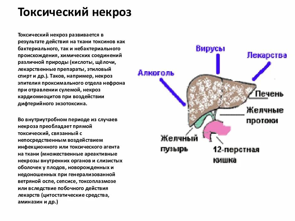 Лечение после некроза. Токсический некроз печени. Причины токсического некроза.