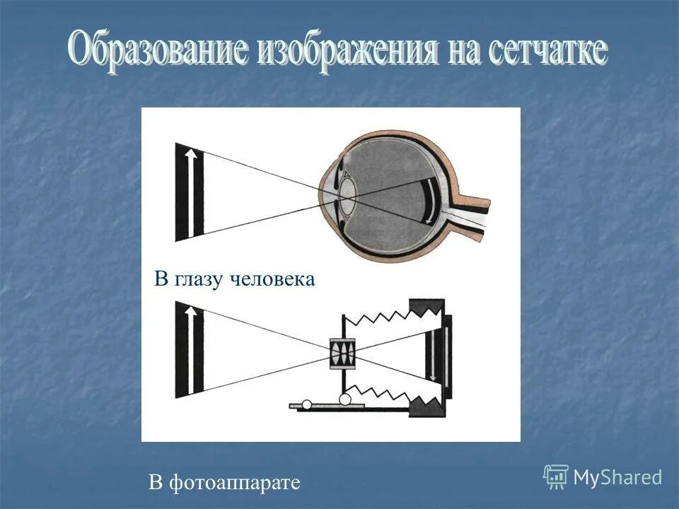 Ход лучей глаза человека. Образование изображения на сетчатке. На сетчатке формируется изображение. Формирование изображения на сетчатке. Построение изображения на сетчатке глаза.