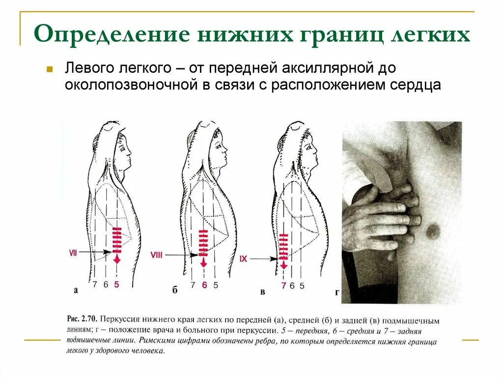 Границы легких определяются. Перкуссия легких пропедевтика внутренних болезней. Перкуссия грудной клетки пропедевтика внутренних болезней. Сравнительная перкуссия легких пропедевтика. Топографическая перкуссия грудной клетки пропедевтика.