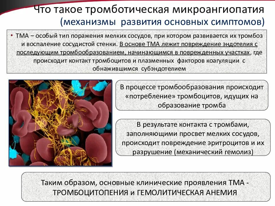 Микроангиопатия головного мозга fazekas. Тромботическая микроангиопатия гистология. Тромбоцитарная микроангиопатия. Микроангиопатия синдром. Диагностические критерии тромботических микроангиопатий.