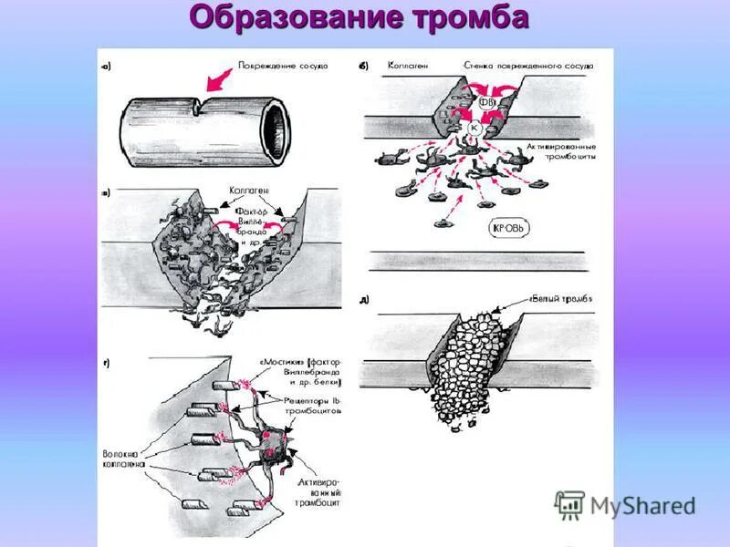 Как образуется тромб. Этапы образования тромба. гемостаз образование тромба.