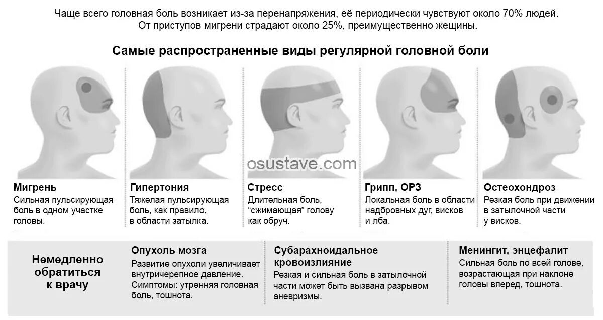 Может от. Головные боли сзади затылочной части. Головная боль в области шеи и затылка сзади. Болит задняя часть головы затылок. Зоны головной боли.