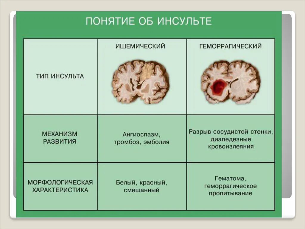 Механизм развития ишемического инсульта. Механизм развития ишемического инсульта таблица. Инсульт бывает ишемический и геморрагический. Ишемический и геморрагический инсульт головного мозга.