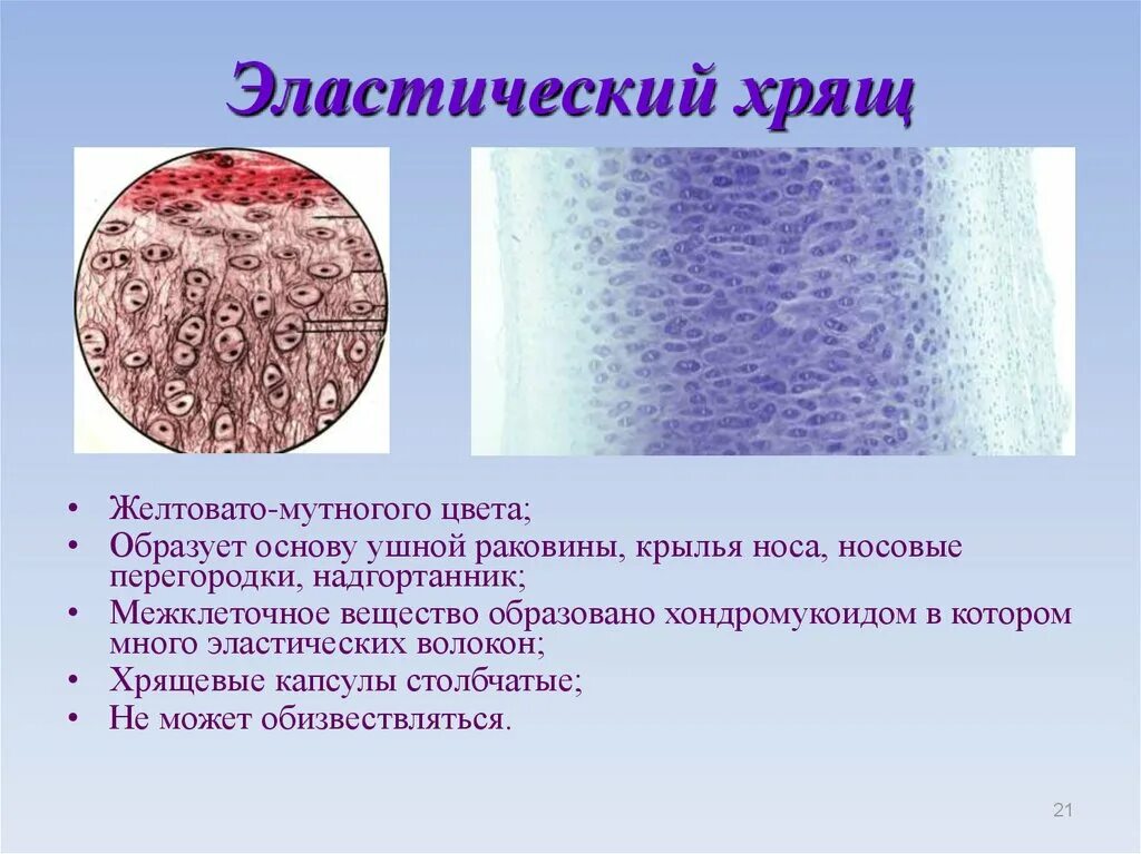 Эластический хрящ гистология препарат. Эластический хрящ ушной раковины свиньи препарат. эластический хрящ ушной раковины гистология. эластический хрящ ушной раковины препарат гистология. эластический хрящ ( эластическая хрящевая ткань).