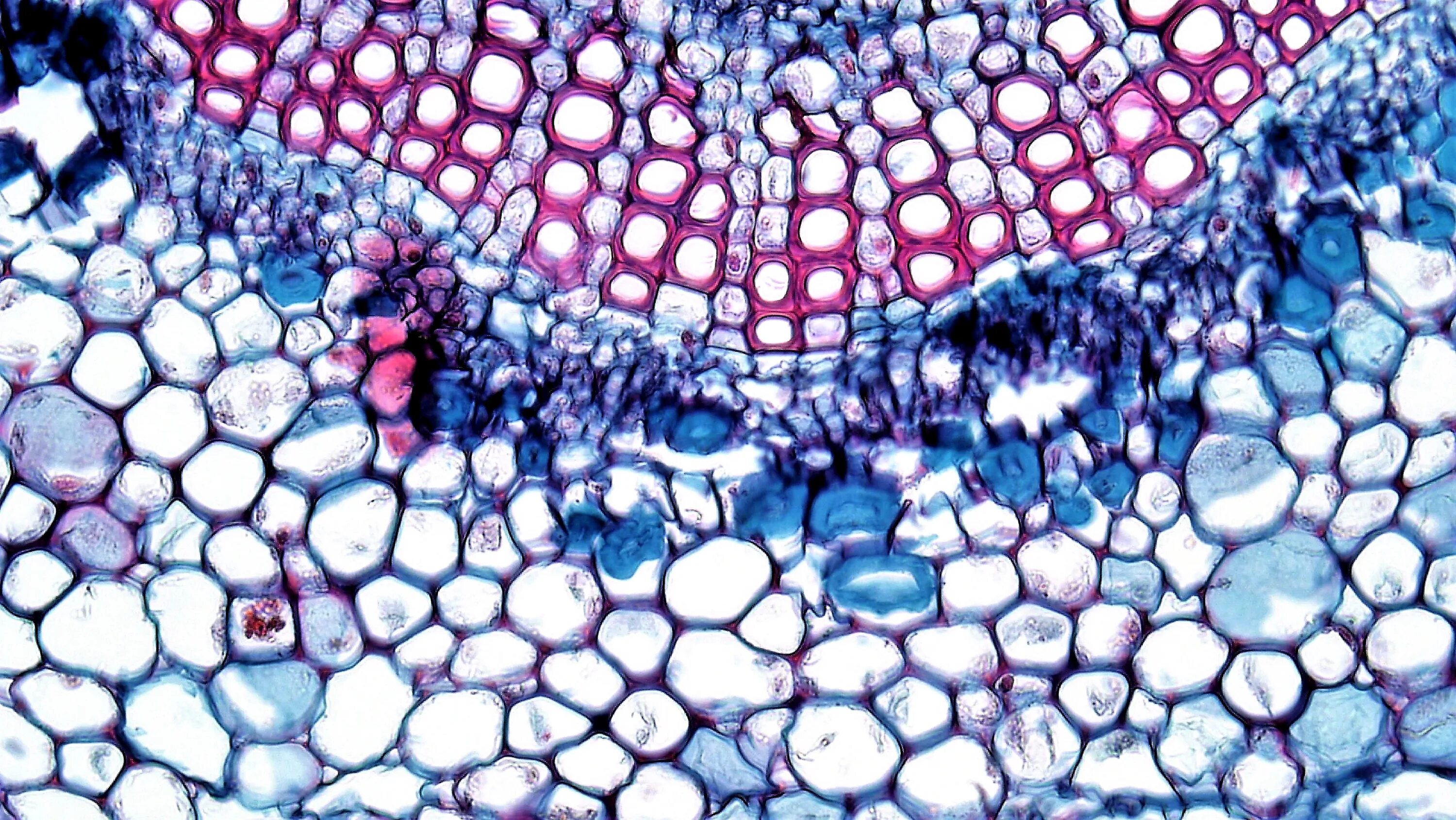 Водоносные клетки в листьях имеет. Xylem and phloem. Ксилема микрофотография. Ксилема микроскоп. Ксилема сканирующая микроскопия.