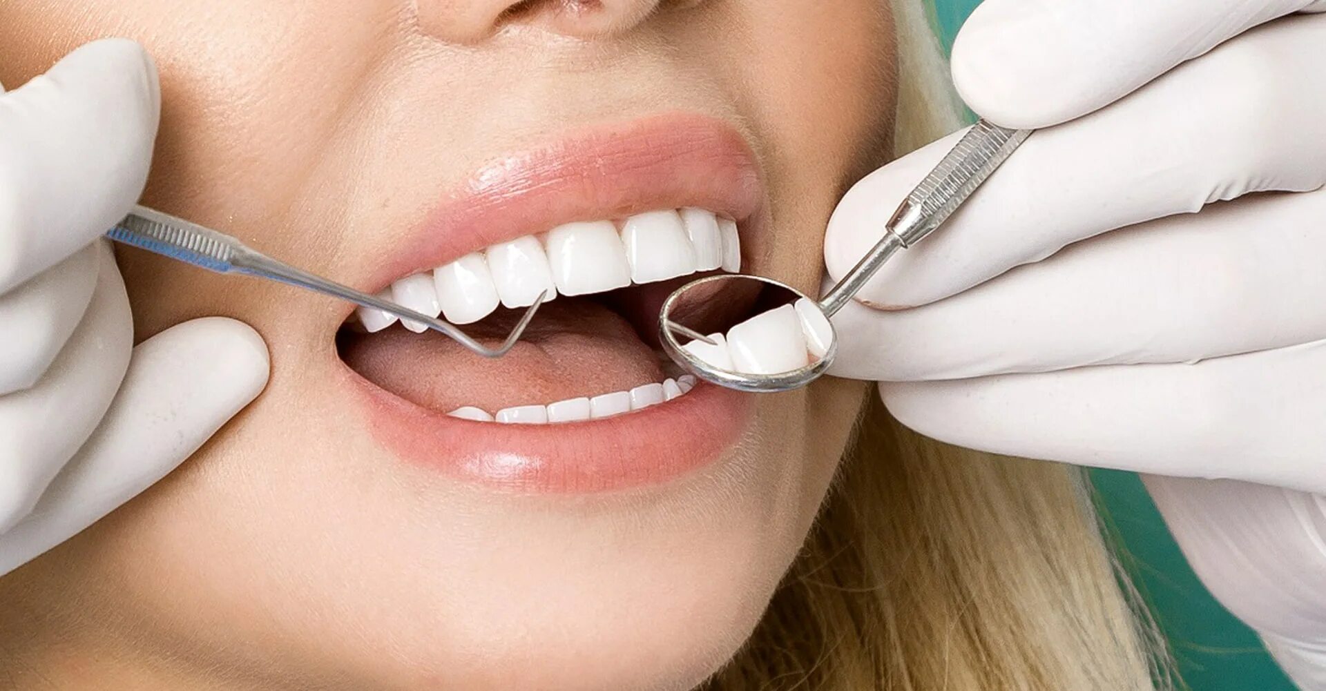 Зубы стоматология. Терапия стоматология. Эстетическая стоматология. Профессиональная гигиена полости рта.