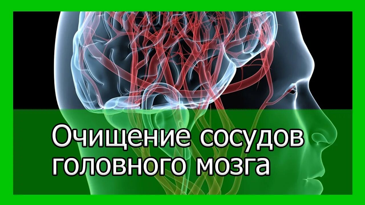 Головного мозга атеросклероз народное средство. Очищение сосудов головного мозга. Средства для чистки сосудов головного мозга. Народные средства для сосудов головы. Очищение сосудов головного мозга народные средства.