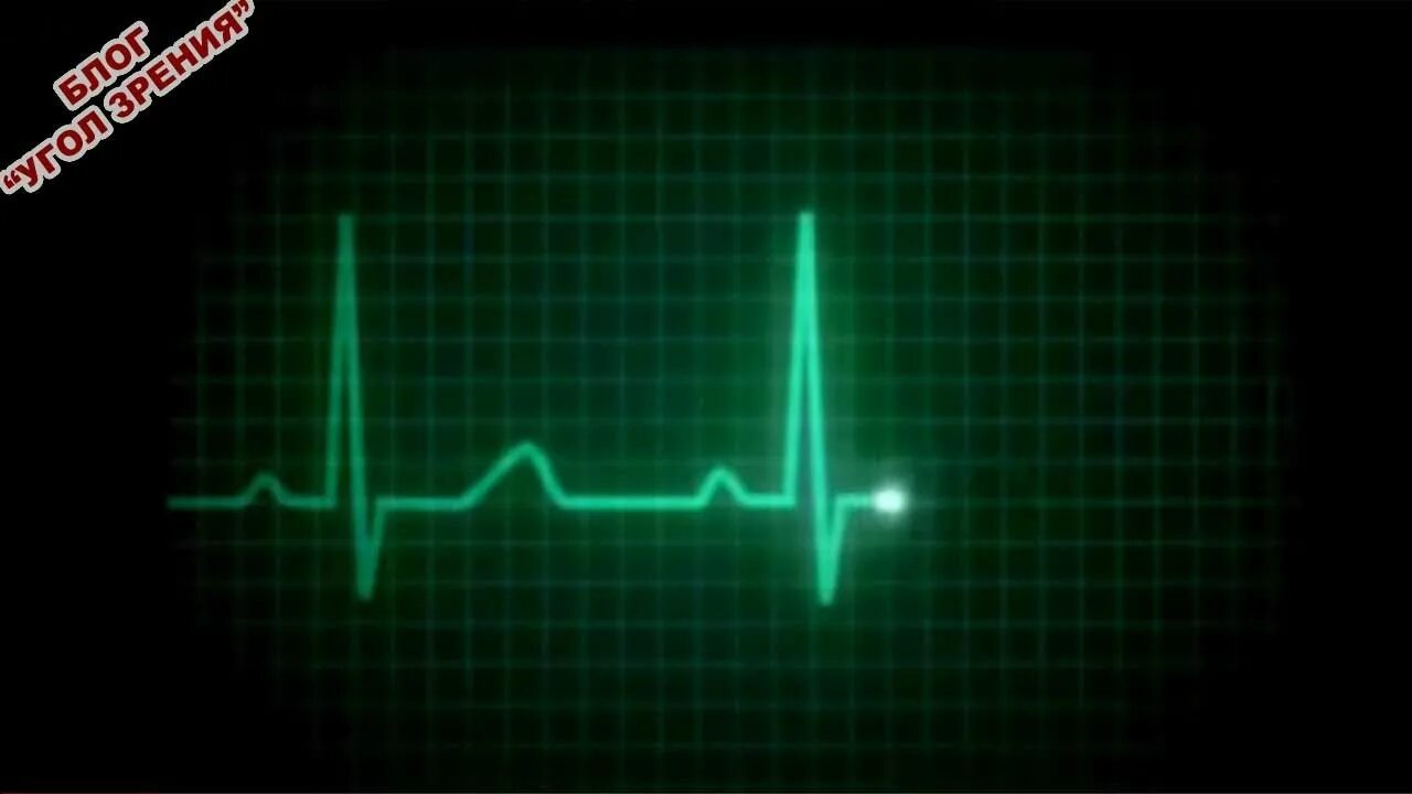 Пульс. Кардиограмма сердца. Линия пульса. Кардиограмма остановки сердца. Сердцебиение остановилось