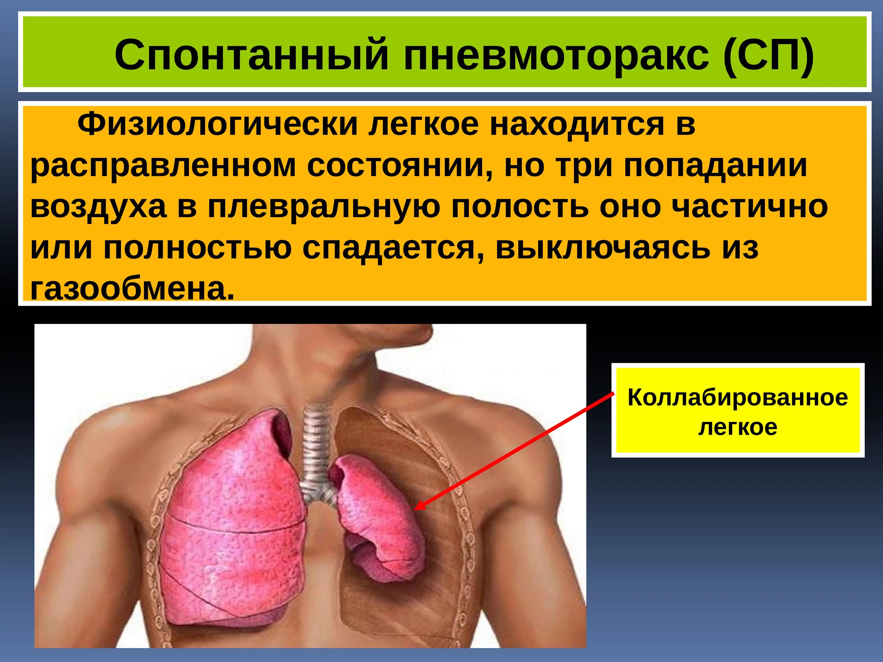 Спонтанный пневмоторакс симптомы туберкулеза. Спонтанный пневмоторакс провоцирующие факторы. Левосторонний спонтанный пневмоторакс. Коллабирование легкого при пневмотораксе. Почему уменьшается легкое